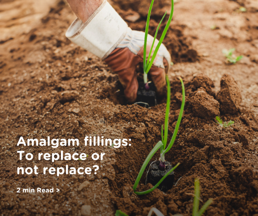 Amalgam Fillings